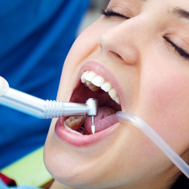 Periodontics gum disease treatment at Secunderabad Dental Hospital